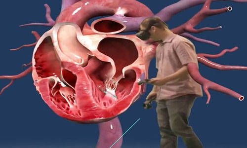 VR虚拟仿真技术在医疗领域的应用-3DCAT实时渲染云平台